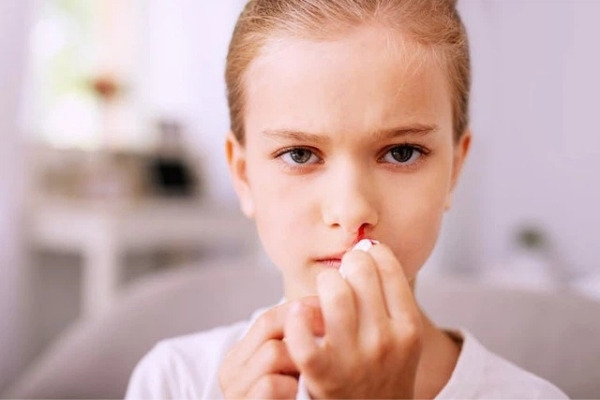 Trẻ bị chảy máu cam khi chấn thương ở mũi