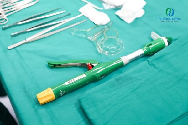 Dụng cụ cắt trĩ bằng phương pháp Longo tại Bệnh viện Phương Đông được nhập khẩu trực tiếp từ Anh quốc
