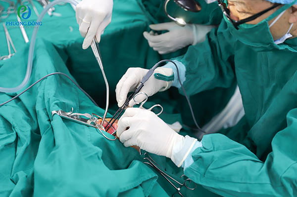 Bác sĩ tiến hành cắt amidan bằng dao plasma