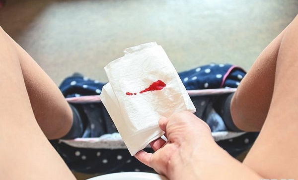 Máu báo thai là hiện tượng chảy máu âm đạo xảy ra khi phôi thai làm tổ trên niêm mạc tử cung