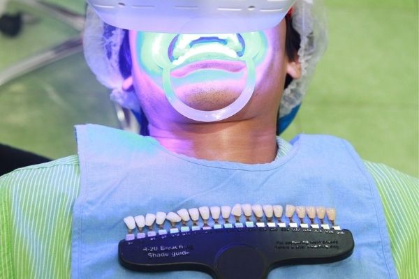 Ánh sáng laser sẽ tác động để thuốc tẩy trắng thẩm thấu vào răng