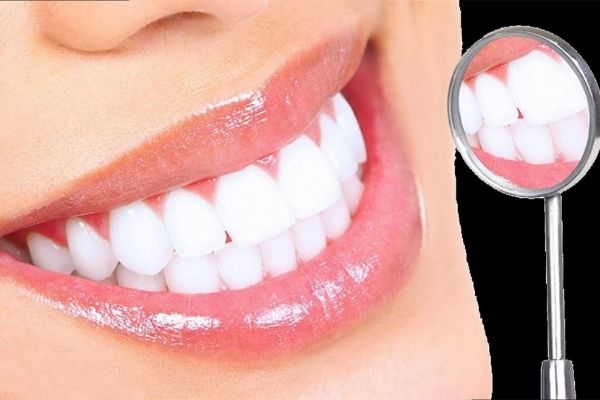 Phương pháp có thể loại bỏ mọi vết ố vàng trên răng