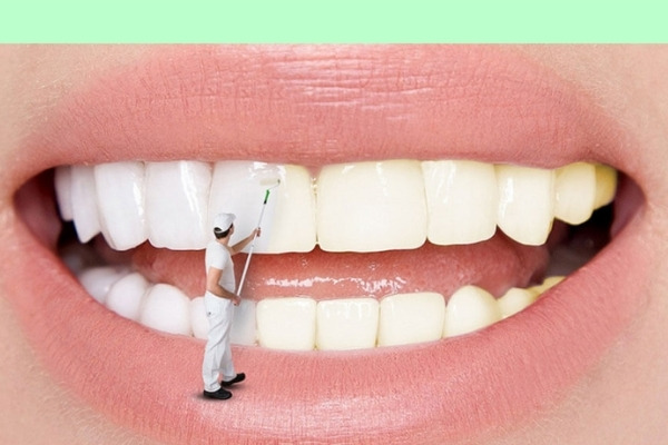 Tẩy trắng răng cho thấy hiệu quả ngay sau khi thực hiện