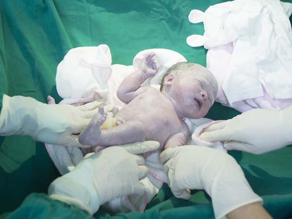 Chất gây của trẻ sơ sinh là chất màu trắng kem bám dính trên da bé khi mới sinh ra