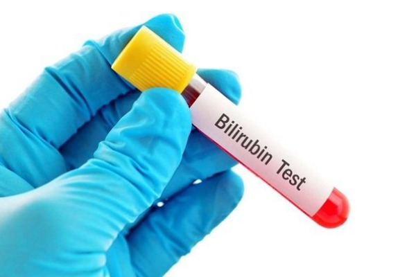 Mức độ bình thường của bilirubin ở trẻ sơ sinh là gì?