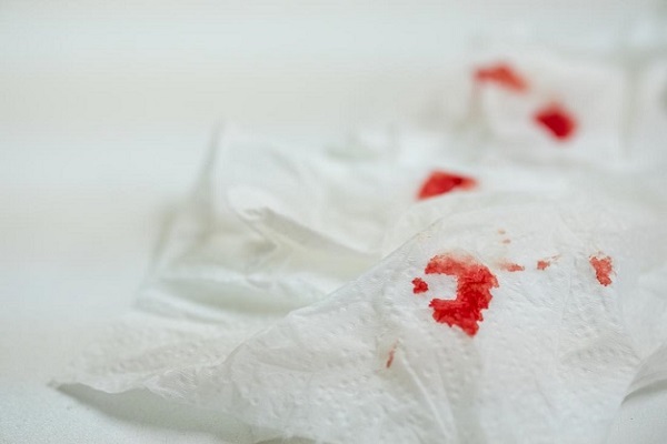 Nứt kẽ hậu môn gây chảy máu khi đi đại tiện nên dễ dẫn đến thiếu máu và nhiễm trùng