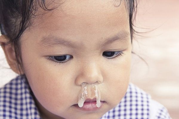 Trẻ bị sổ mũi khiến nhiều cha mẹ lo lắng