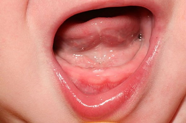 Trẻ mọc răng rất hay quấy khóc và thường xuyên bỏ bú