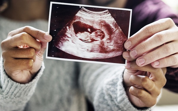 Siêu âm thai giúp xác định chính xác 99,9% giới tính thai nhi