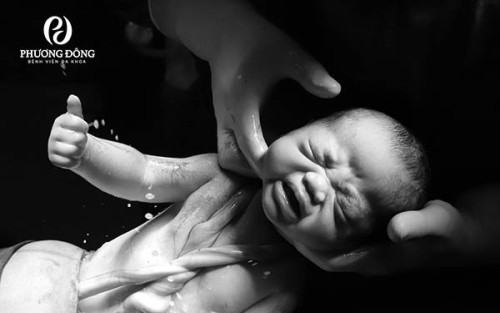 Thai nhi bị dây rốn quấn cổ 1 vòng tuần 32: Nguy hiểm hay không?
