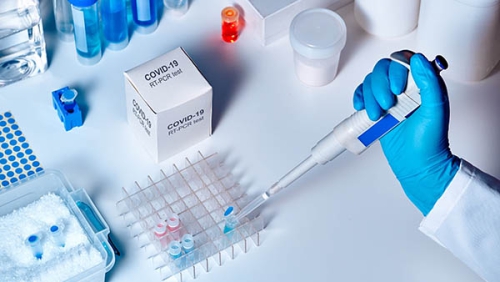 Xét nghiệm COVID-19 bằng phương pháp PCR giá bao nhiêu?