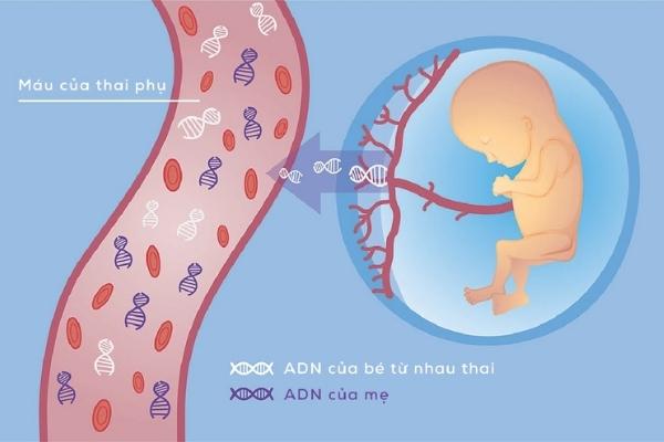 NIPT là kỹ thuật phân tích ADN của thai nhi qua ADN của mẹ