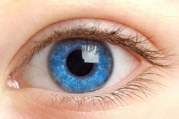 Người bệnh bạch tạng có thể mang màu mắt xanh, xám, vàng nhạt hoặc nâu
