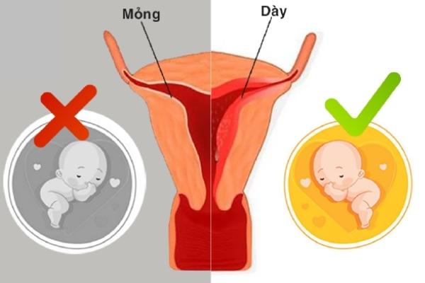 Niêm mạc tử cung khoảng 8- 14mm có thể là có thai