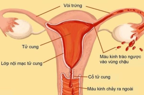 Nội mạc tử cung dày bao nhiêu là có thai?