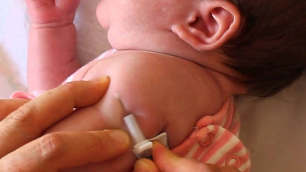 Tiêm vắc-xin BCG phòng lao cho trẻ sơ sinh