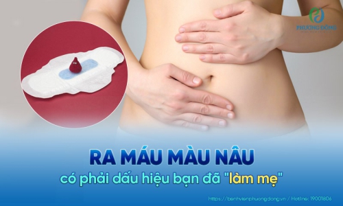Ra dịch màu nâu có thai không và những thông tin cần biết