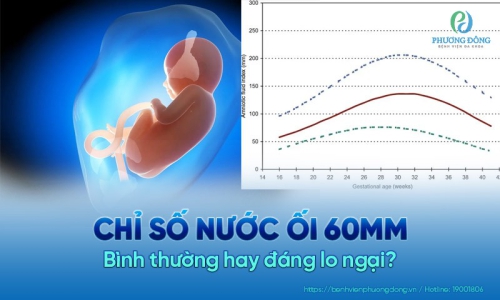 [Giải đáp thắc mắc] Chỉ số nước ối 60mm có bình thường?