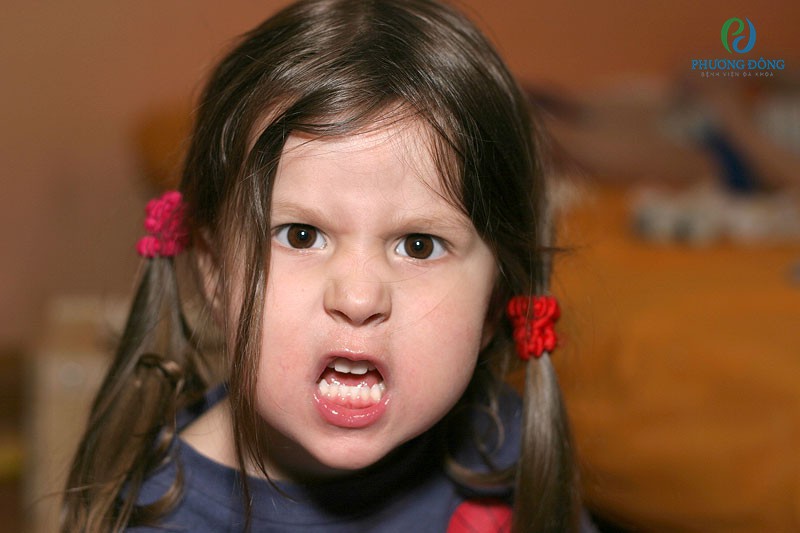 Trẻ em cáu giận vô cơ là dấu hiệu của rối loạn tâm trạng hỗn hợp