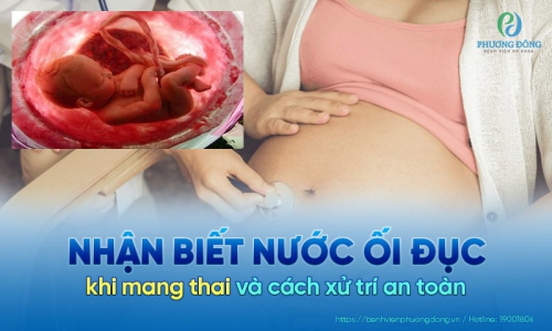 Nước ối đục cảnh báo nguy hiểm gì? Cần giải quyết ra sao?