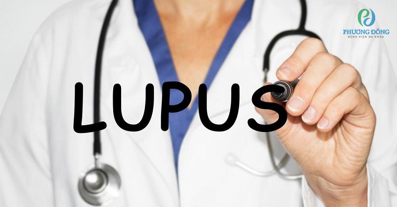 Tình trạng của bệnh nhân lupus ban đỏ sẽ ra sao nếu không chữa trị triệt để?
