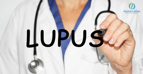 Bệnh Lupus ban đỏ và sự nguy hiểm của bệnh là gì?