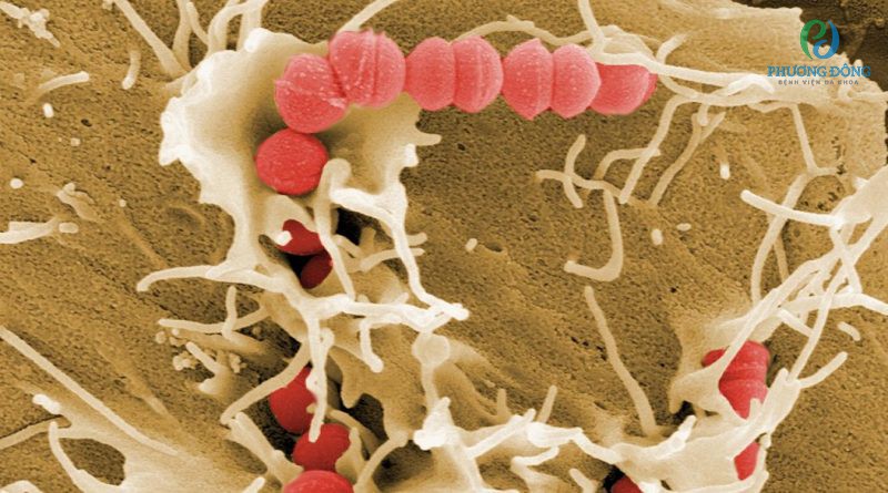 Vi khuẩn Streptococcus pyogenes gây nhiễm khuẩn mô mềm