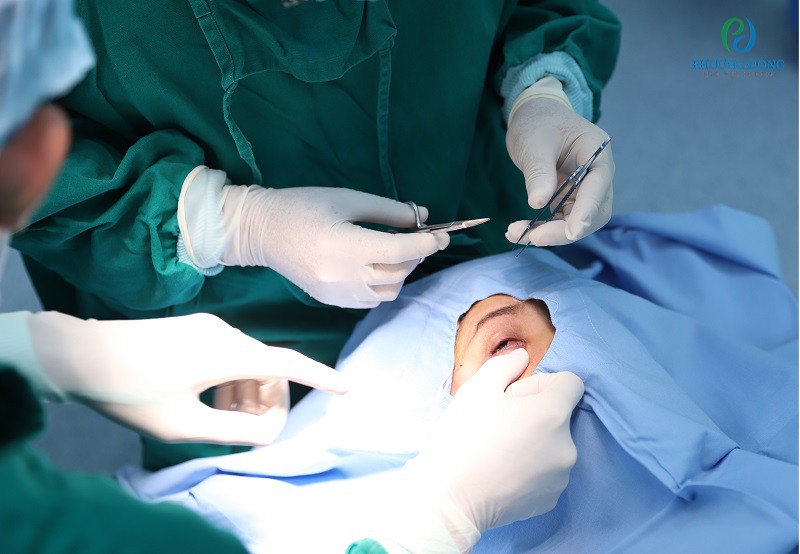 Phẫu thuật điều trị viêm mô tế bào trước mắt tại BVĐK Phương Đông