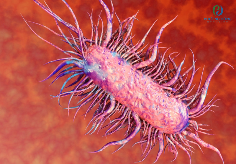 Vi khuẩn E-coli là vi khuẩn chủ yếu gây nên tình trạng viêm nhiễm tuyến tiền liệt