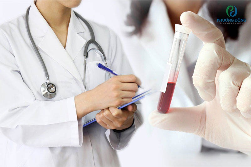 Bác sĩ khuyến cáo xét nghiệm gan định kỳ để theo dõi, kiểm tra sức khỏe