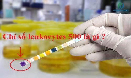 [Phương Đông giải đáp] Chỉ số leukocytes 500 là gì? 
