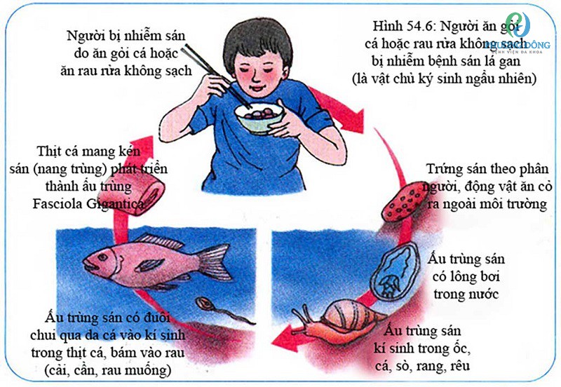Người bị nhiễm sán lá gan do ăn gỏi cá hoặc rau chưa được rửa kỹ
