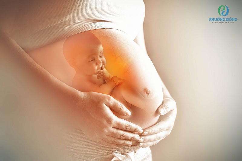 U buồng trứng xoắn thường xảy ra ở nhóm phụ nữ mang thai