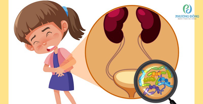 Viêm đường tiết niệu ở trẻ xảy ra do sự tấn công của vi khuẩn