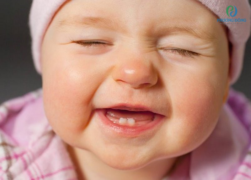 Sự phát triển răng ở mỗi đứa trẻ sẽ không giống nhau