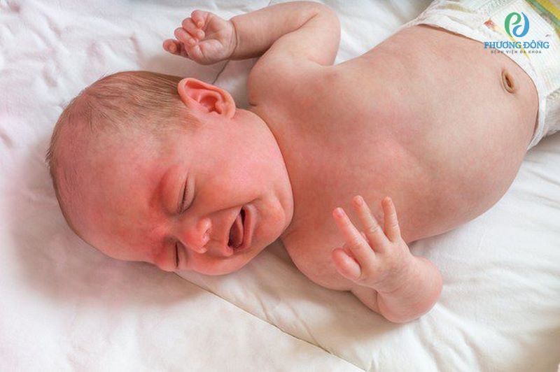 Rối loạn chuyển hoá ở trẻ sơ sinh thường do bẩm sinh