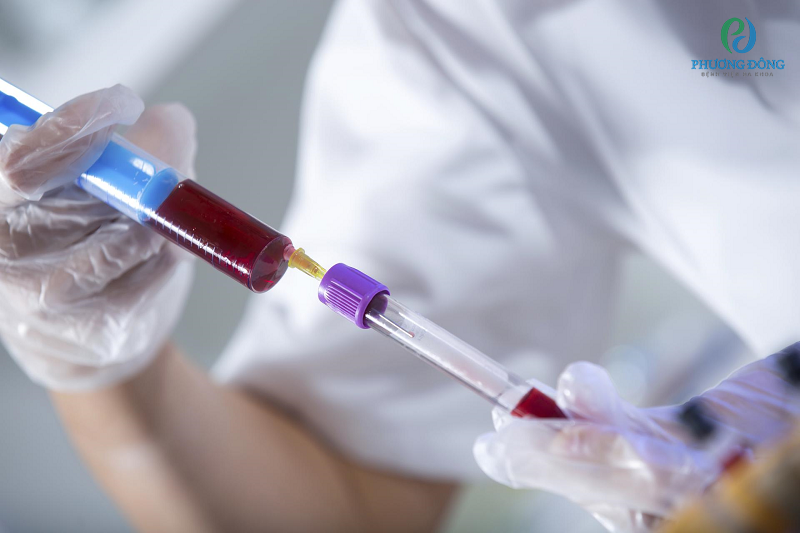 Xét nghiệm máu PAPP-A là phương pháp gì?