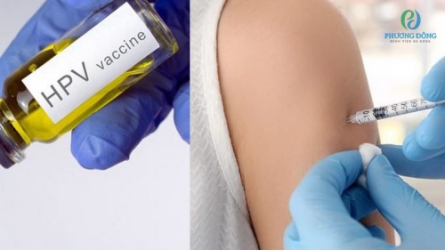 Trước và sau khi tiêm HPV kiêng gì để đảm bảo hiệu quả?