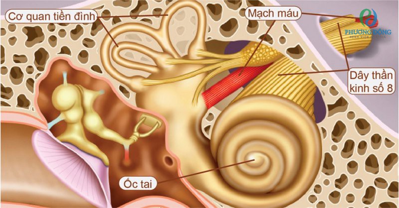 Dây thần kinh số 8 ảnh hưởng trực tiếp đến ốc tai và cơ quan tiền đình dẫn đến ù tai, chóng mặt khiến người bệnh đầu óc quay cuồng