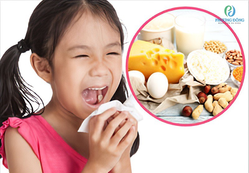 Trẻ nhỏ dễ bị dị ứng với chất đạm lạ từ trứng, sữa, bơ