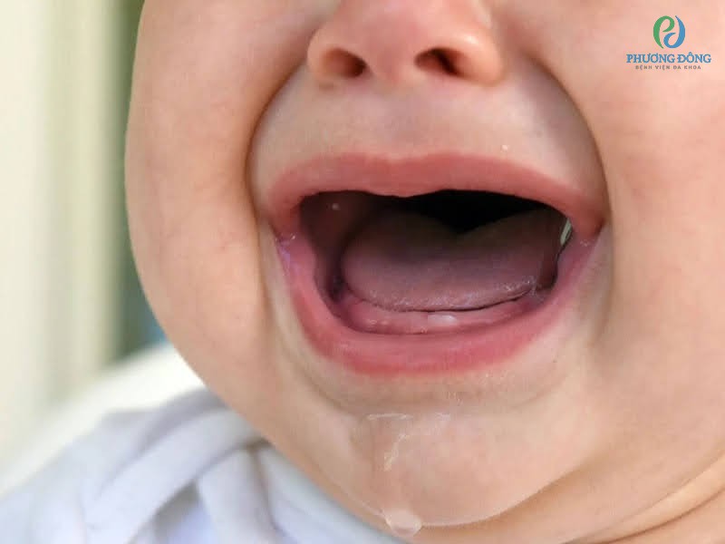 Trẻ trước khi mọc răng thường chảy dãi nhiều và thường xuyên quấy khóc