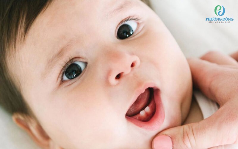 Hình ảnh lợi trẻ sắp mọc răng: Răng sữa thông thường sẽ bắt đầu mọc khi trẻ 6-7 tháng tuổi
