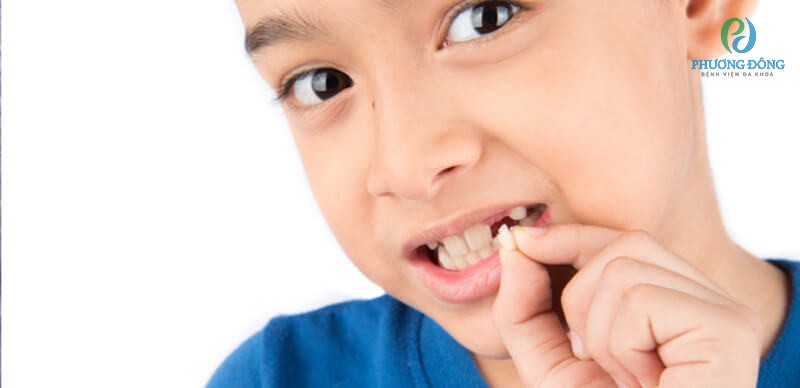 Răng vĩnh viễn bắt đầu thay khi trẻ được 6-7 tuổi