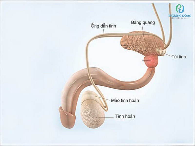 Tắc ống dẫn tinh là bệnh lý ảnh hưởng đến sức khỏe sinh sản nam giới