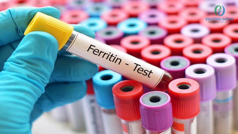 Xét nghiệm Ferritin để đánh giá tình trạng hoại tử gan