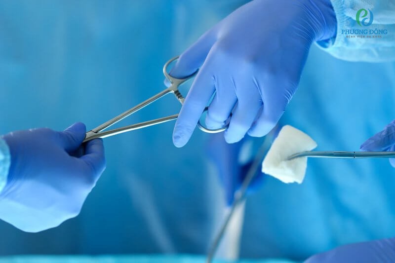 Có 3 phương pháp cắt bỏ tử cung được áp dụng hiện nay