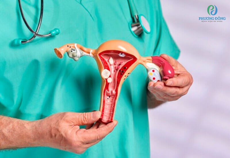 Cắt tử cung sẽ được thực hiện sau khi bệnh nhân và người nhà đồng ý