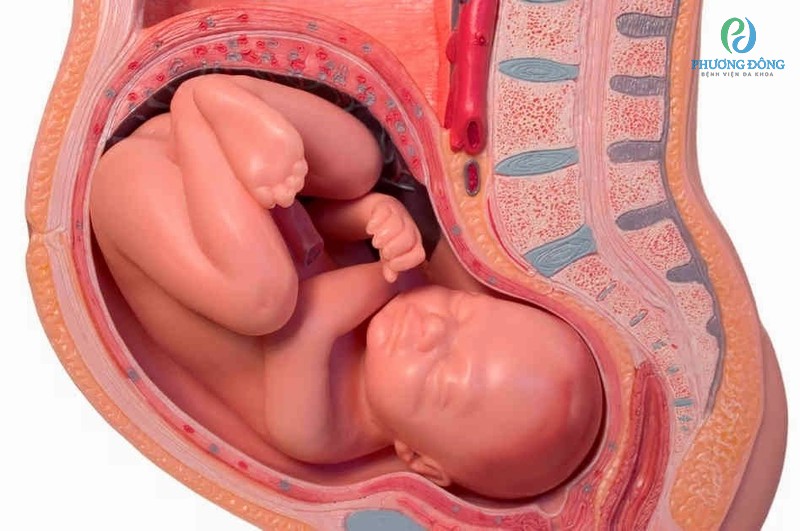 Nguyên nhân dọa sinh non có thể xuất phát từ việc thai nhi bị dị tật