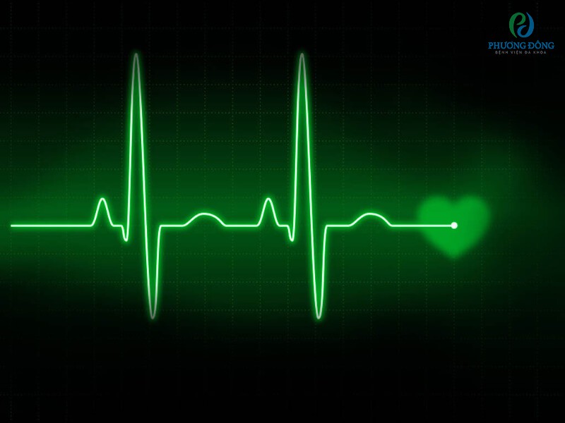 Điện tâm đồ giúp phát hiện các rối loạn nhịp tim.