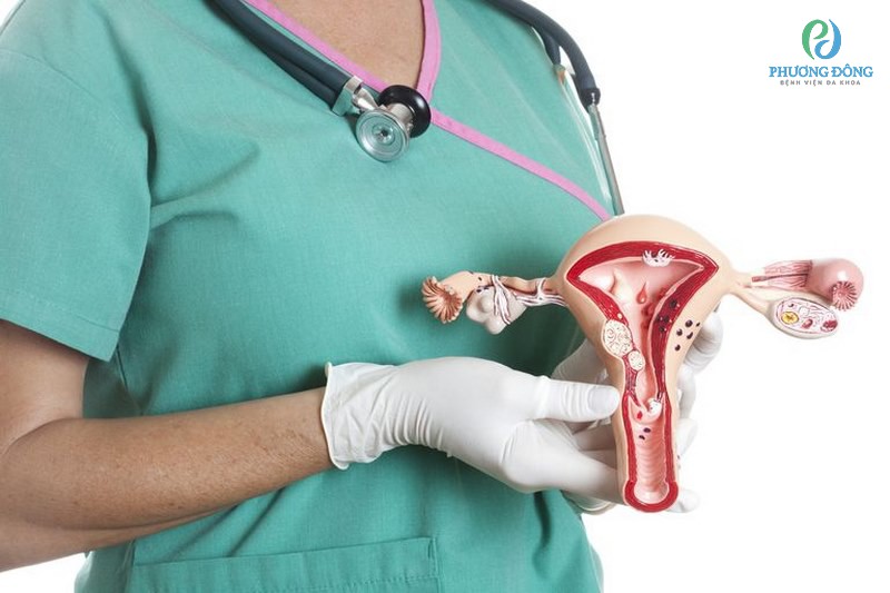 Cắt tử cung để khuyến nghị cắt để điều trị những bệnh nguy hiểm ở tử cung
